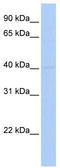 Upstream stimulatory factor 2 antibody, TA334011, Origene, Western Blot image 
