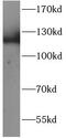 EMAP Like 4 antibody, FNab10047, FineTest, Western Blot image 