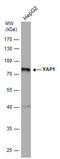 Yes Associated Protein 1 antibody, GTX633541, GeneTex, Western Blot image 