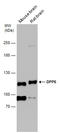 Dipeptidyl Peptidase Like 6 antibody, GTX133338, GeneTex, Western Blot image 
