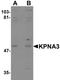 Karyopherin Subunit Alpha 3 antibody, orb94588, Biorbyt, Western Blot image 