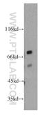 Homeobox protein PKNOX2 antibody, 20352-1-AP, Proteintech Group, Western Blot image 