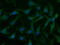 Uridine-Cytidine Kinase 1 antibody, LS-C115508, Lifespan Biosciences, Immunofluorescence image 
