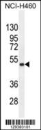 Fibronectin Type III Domain Containing 8 antibody, 55-820, ProSci, Western Blot image 