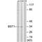 Bone Marrow Stromal Cell Antigen 1 antibody, PA5-49971, Invitrogen Antibodies, Western Blot image 
