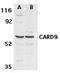 Caspase Recruitment Domain Family Member 9 antibody, ADI-905-188-100, Enzo Life Sciences, Western Blot image 