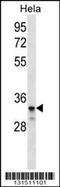 Low Density Lipoprotein Receptor Class A Domain Containing 2 antibody, TA324494, Origene, Western Blot image 
