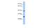 Chromosome 12 Open Reading Frame 42 antibody, GTX45395, GeneTex, Western Blot image 