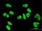 PRK1 antibody, H00005585-M01, Novus Biologicals, Immunocytochemistry image 