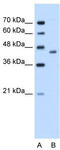 Alcohol Dehydrogenase 1B (Class I), Beta Polypeptide antibody, TA346213, Origene, Western Blot image 