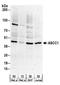 Activating Signal Cointegrator 1 Complex Subunit 1 antibody, A303-871A, Bethyl Labs, Western Blot image 