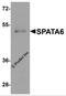 Spermatogenesis Associated 6 antibody, 6555, ProSci, Western Blot image 
