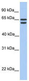 Chromodomain Y Like 2 antibody, TA330973, Origene, Western Blot image 
