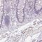 AL592183.1 antibody, NBP2-48931, Novus Biologicals, Immunohistochemistry frozen image 
