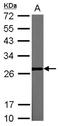 Lin-28 Homolog A antibody, NBP2-19355, Novus Biologicals, Western Blot image 