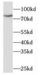MDM4 Regulator Of P53 antibody, FNab05078, FineTest, Western Blot image 
