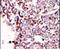 TYRO3 Protein Tyrosine Kinase antibody, PA5-14737, Invitrogen Antibodies, Immunohistochemistry paraffin image 
