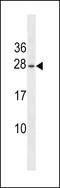Erythropoietin antibody, LS-C159567, Lifespan Biosciences, Western Blot image 