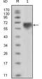 TYRO3 Protein Tyrosine Kinase antibody, MA5-15505, Invitrogen Antibodies, Western Blot image 
