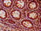 Histone Cluster 1 H1 Family Member E antibody, LS-C676868, Lifespan Biosciences, Immunohistochemistry paraffin image 