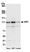 Huntingtin-interacting protein 1 antibody, A305-176A, Bethyl Labs, Western Blot image 