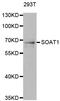 Sterol O-Acyltransferase 1 antibody, LS-C334633, Lifespan Biosciences, Western Blot image 