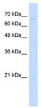 Zinc finger protein 654 antibody, TA331869, Origene, Western Blot image 