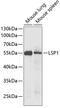Lymphocyte-specific protein 1 antibody, A02992, Boster Biological Technology, Western Blot image 