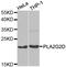 Phospholipase A2 Group IID antibody, A6690, ABclonal Technology, Western Blot image 