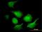 Adenylate Kinase 1 antibody, MA5-18367, Invitrogen Antibodies, Immunofluorescence image 
