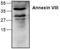 Annexin A8 antibody, TA318939, Origene, Western Blot image 