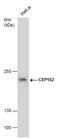Centrosomal Protein 152 antibody, GTX631486, GeneTex, Western Blot image 