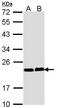 Calcineurin Like EF-Hand Protein 1 antibody, PA5-29876, Invitrogen Antibodies, Western Blot image 