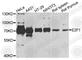 E2F-1 antibody, A2442, ABclonal Technology, Western Blot image 