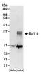 BAF Chromatin Remodeling Complex Subunit BCL11B antibody, NB600-263, Novus Biologicals, Western Blot image 