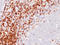 CD5 Molecule antibody, AM50190PU-S, Origene, Immunohistochemistry frozen image 