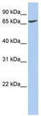 Vacuolar adenosine triphosphatase subunit Ac116 antibody, TA339002, Origene, Western Blot image 