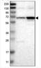 Solute Carrier Family 4 Member 11 antibody, NBP1-88514, Novus Biologicals, Western Blot image 