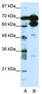 Zinc Finger Protein 76 antibody, TA343392, Origene, Western Blot image 