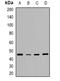 Rh Blood Group D Antigen antibody, orb382516, Biorbyt, Western Blot image 