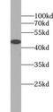 Ubiquitin Specific Peptidase 45 antibody, FNab09335, FineTest, Western Blot image 