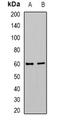 Cytochrome P450 Family 4 Subfamily F Member 12 antibody, orb378023, Biorbyt, Western Blot image 