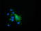 Epoxide hydrolase 2 antibody, M01999-1, Boster Biological Technology, Immunofluorescence image 