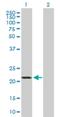 Germinal Center Associated Signaling And Motility antibody, H00257144-B01P, Novus Biologicals, Western Blot image 