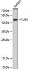 FUT5 antibody, GTX32612, GeneTex, Western Blot image 