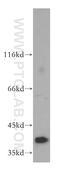 Ras-related GTP-binding protein B antibody, 13023-1-AP, Proteintech Group, Western Blot image 
