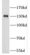 Elongation Factor Like GTPase 1 antibody, FNab02663, FineTest, Western Blot image 