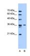 Solute Carrier Family 35 Member A3 antibody, orb325104, Biorbyt, Western Blot image 