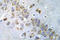 PTK2 antibody, AP20939PU-N, Origene, Immunohistochemistry frozen image 