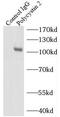 Polycystin-2 antibody, FNab06635, FineTest, Immunoprecipitation image 